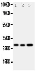 1 - Anti-OSM/Oncostatin M Antibody ABO10983