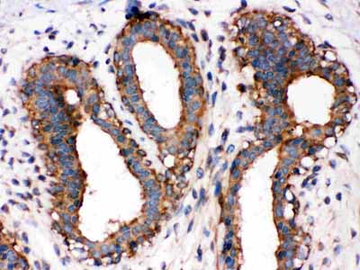2 - Anti-NF-kB p65 Antibody ABO10984