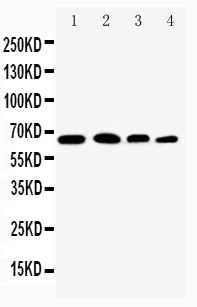 1 - Anti-NF-kB p65 Antibody ABO10984