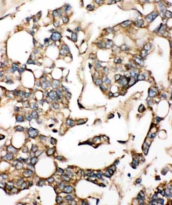 2 - Anti-SLC10A1 Antibody ABO10985