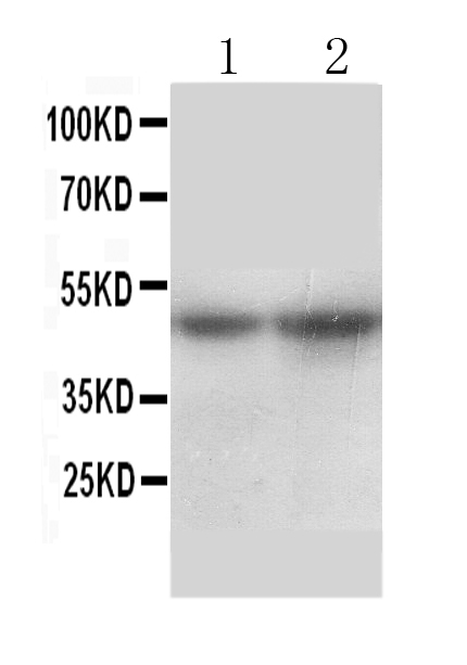 1 - Anti-SLC10A1 Antibody ABO10985
