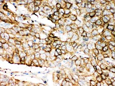 2 - Anti-ALDH1A1 Antibody ABO10986