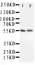 1 - Anti-ALDH1A1 Antibody ABO10986