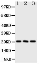 1 - Anti-FGF21 Antibody ABO10987