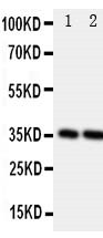 1 - Anti-Podoplanin/gp36 Antibody ABO10989