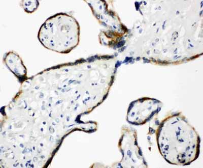 2 - Anti-ERp57 Antibody ABO10992