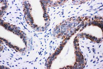 2 - Anti-PIK3R2 Antibody ABO10993