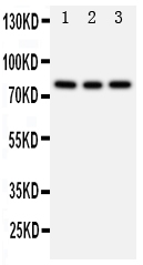1 - Anti-PIK3R2 Antibody ABO10993