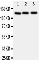 1 - Anti-PPP1R12A Antibody ABO10994