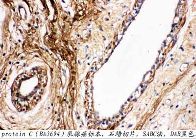 2 - Anti-Protein C Antibody ABO10995