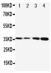1 - Anti-Protein C Antibody ABO10995