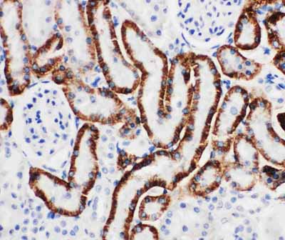 2 - Anti-SLC22A6 Antibody ABO10996