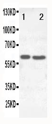 1 - Anti-SLC22A6 Antibody ABO10996