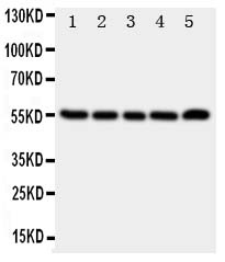1 - Anti-TACR1 Antibody ABO10997