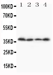 1 - Anti-Stra8 Antibody ABO10998