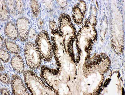 2 - Anti-TFF1 Antibody ABO11000