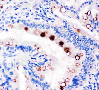 2 - Anti-TFF1 Antibody ABO11001