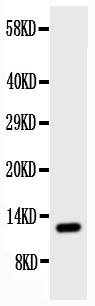 1 - Anti-TFF1 Antibody ABO11001