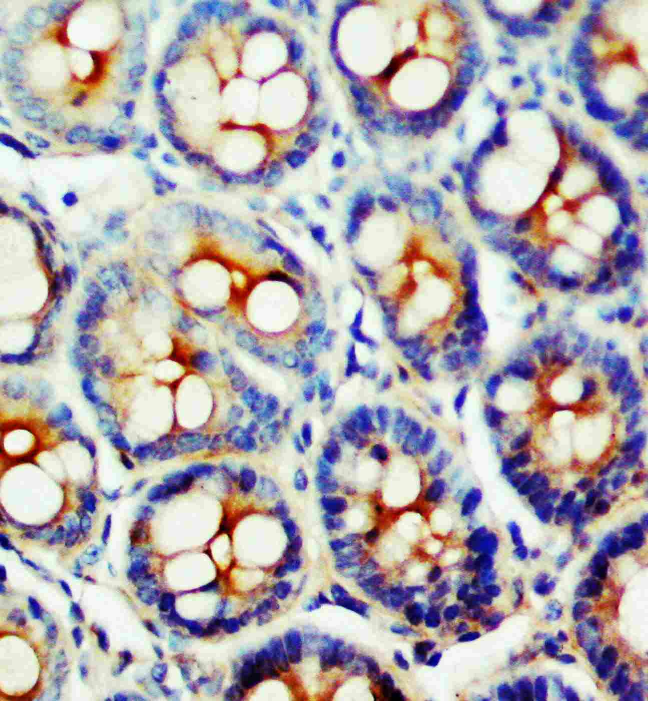 2 - Anti-Somatostatin Receptor 1 Antibody ABO11003