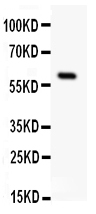 1 - Anti-Somatostatin Receptor 1 Antibody ABO11003