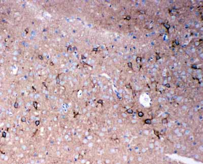 2 - Anti-TNR Antibody ABO11005