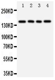 1 - Anti-TNR Antibody ABO11005