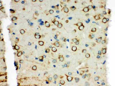 2 - Anti-XRCC3 Antibody ABO11007