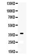 1 - Anti-XRCC3 Antibody ABO11007