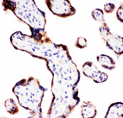 2 - Anti-CYP11A1 Antibody ABO11008