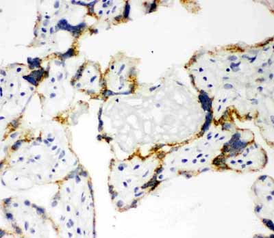 2 - Anti-CYP11A1 Antibody ABO11008