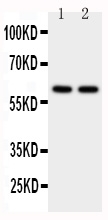 1 - Anti-CYP11A1 Antibody ABO11008