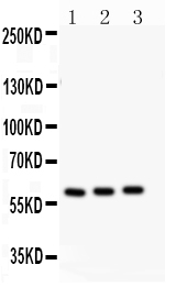 1 - Anti-CYP11A1 Antibody ABO11009