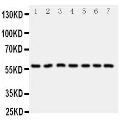 1 - Anti-CYP11B1 Antibody ABO11010