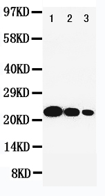 1 - Anti-IL-6 Antibody ABO11011