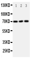 1 - Anti-SLC6A4 Antibody ABO11017