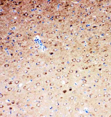 2 - Anti-SLC6A4 Antibody ABO11018