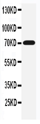 1 - Anti-SLC6A4 Antibody ABO11018