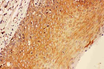 2 - Anti-SOCS3 Antibody ABO11019
