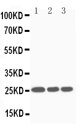 1 - Anti-SOCS3 Antibody ABO11019