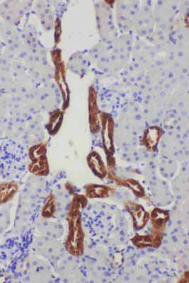 2 - Anti-KLK1 Antibody ABO11021