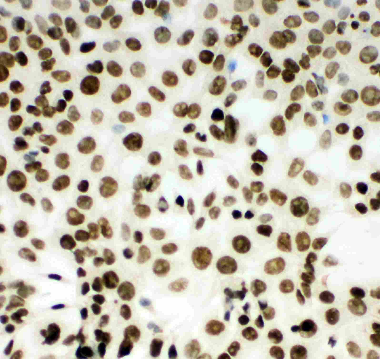 8 - Anti-MCM2 Antibody ABO11022