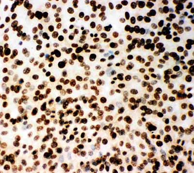 8 - Anti-MCM2 Antibody ABO11022