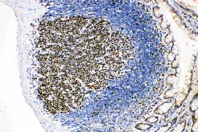 2 - Anti-MCM2 Antibody ABO11022