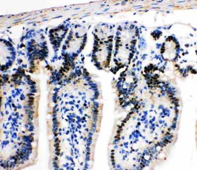 2 - Anti-MCM2 Antibody ABO11022