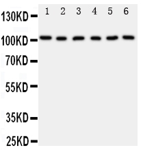 1 - Anti-MCM2 Antibody ABO11022