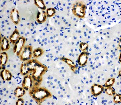 2 - Anti-PBP Antibody ABO11023