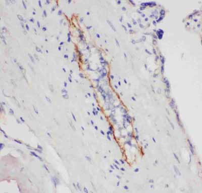 2 - Anti-P-Selectin Antibody ABO11025