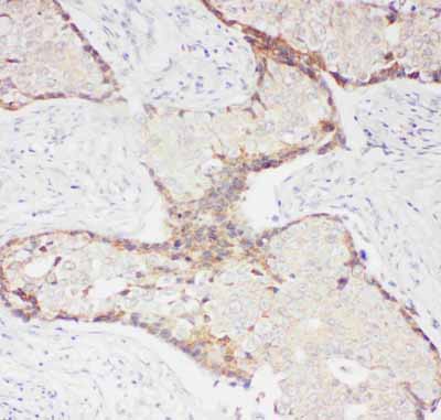 2 - Anti-P-Selectin Antibody ABO11025