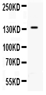 1 - Anti-P-Selectin Antibody ABO11025