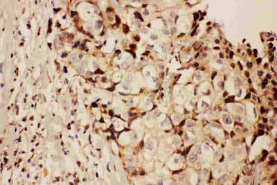 2 - Anti-RFC1 Antibody ABO11026